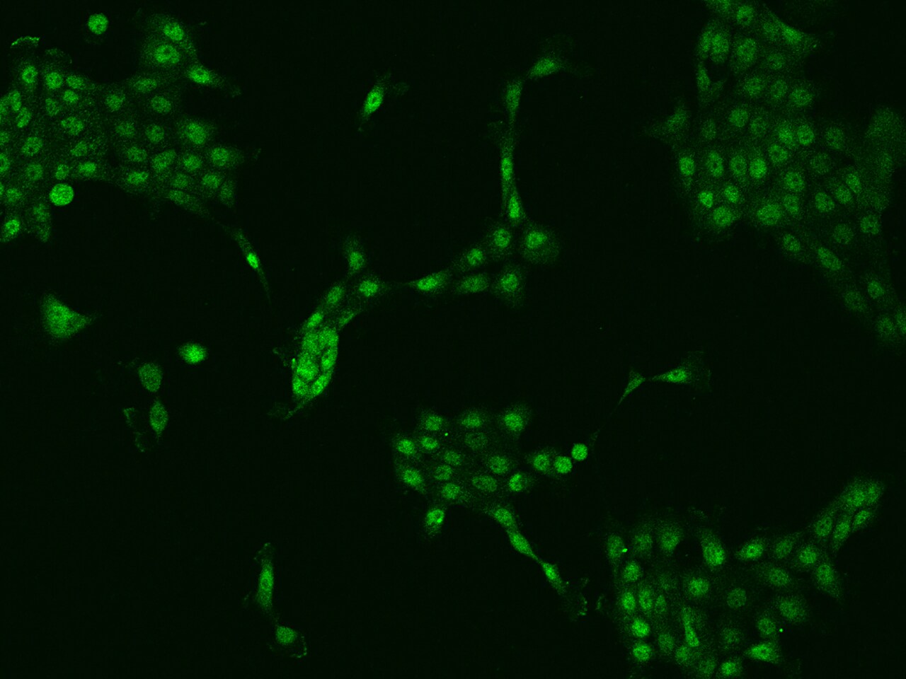 ZNF251 Antibody - BSA Free