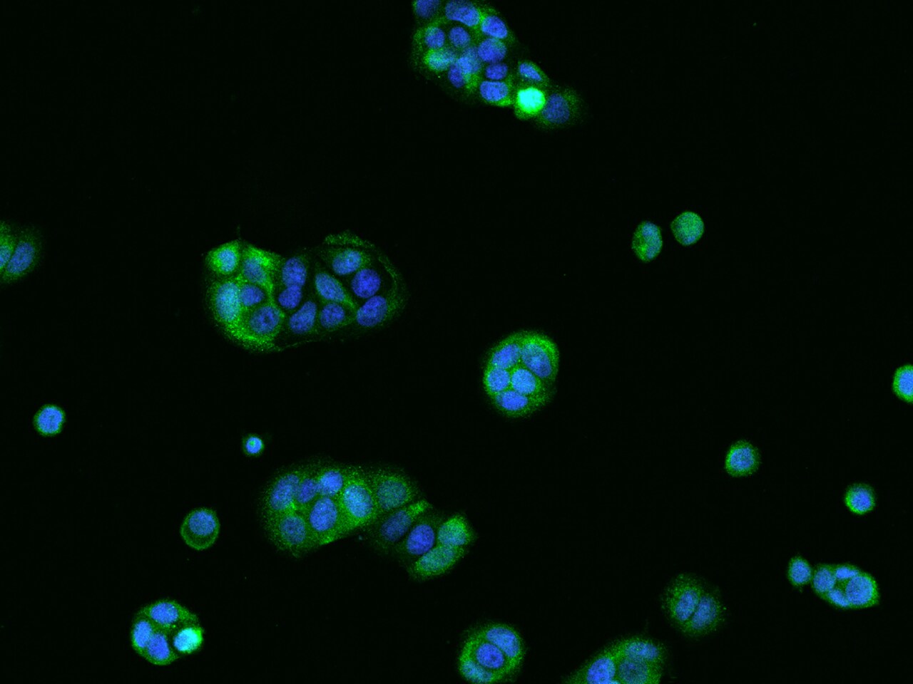 TPPP2 Antibody - BSA Free