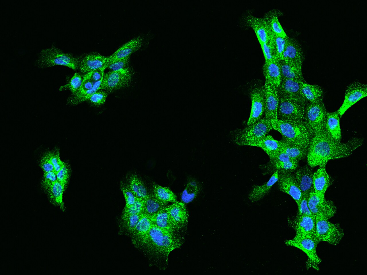 ACOX1 Antibody - BSA Free