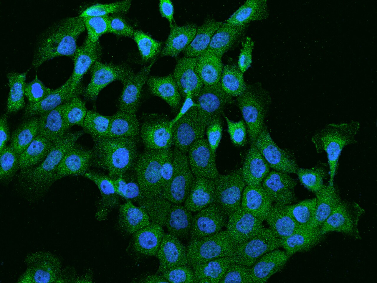 PI 4 Kinase type 2 beta Antibody - BSA Free