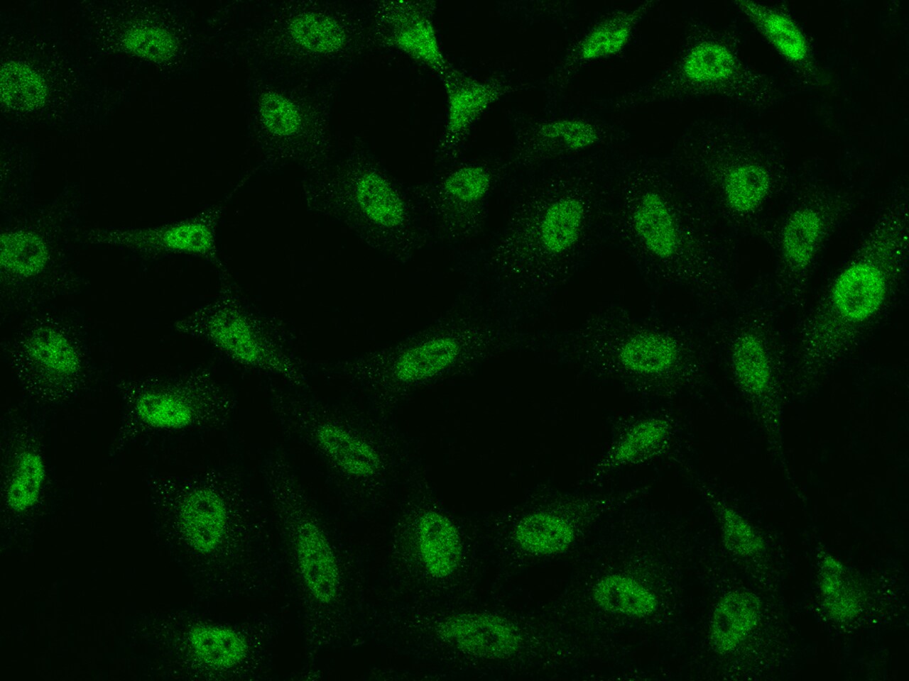 TATDN1 Antibody - BSA Free
