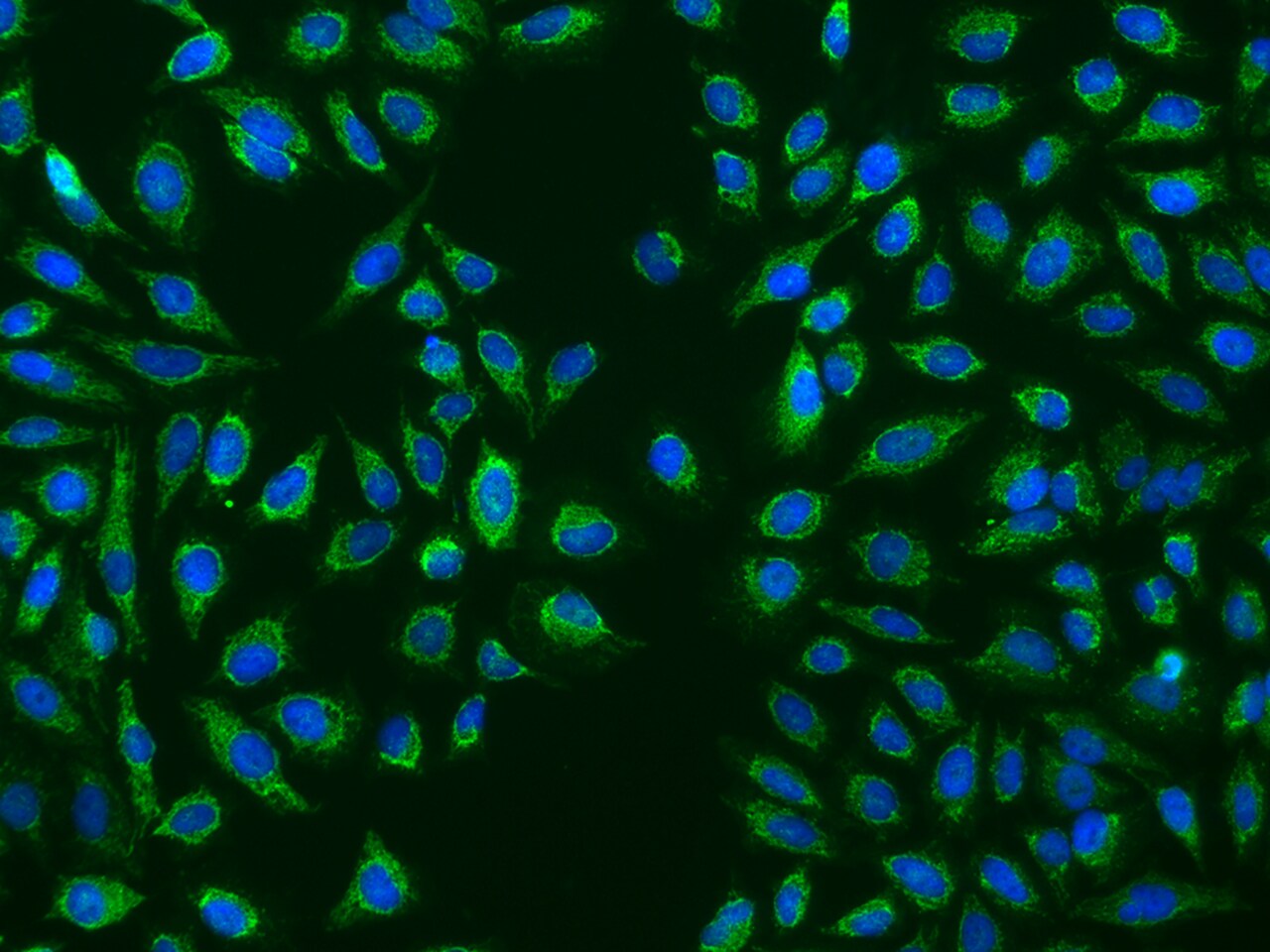 HMGCL Antibody - BSA Free