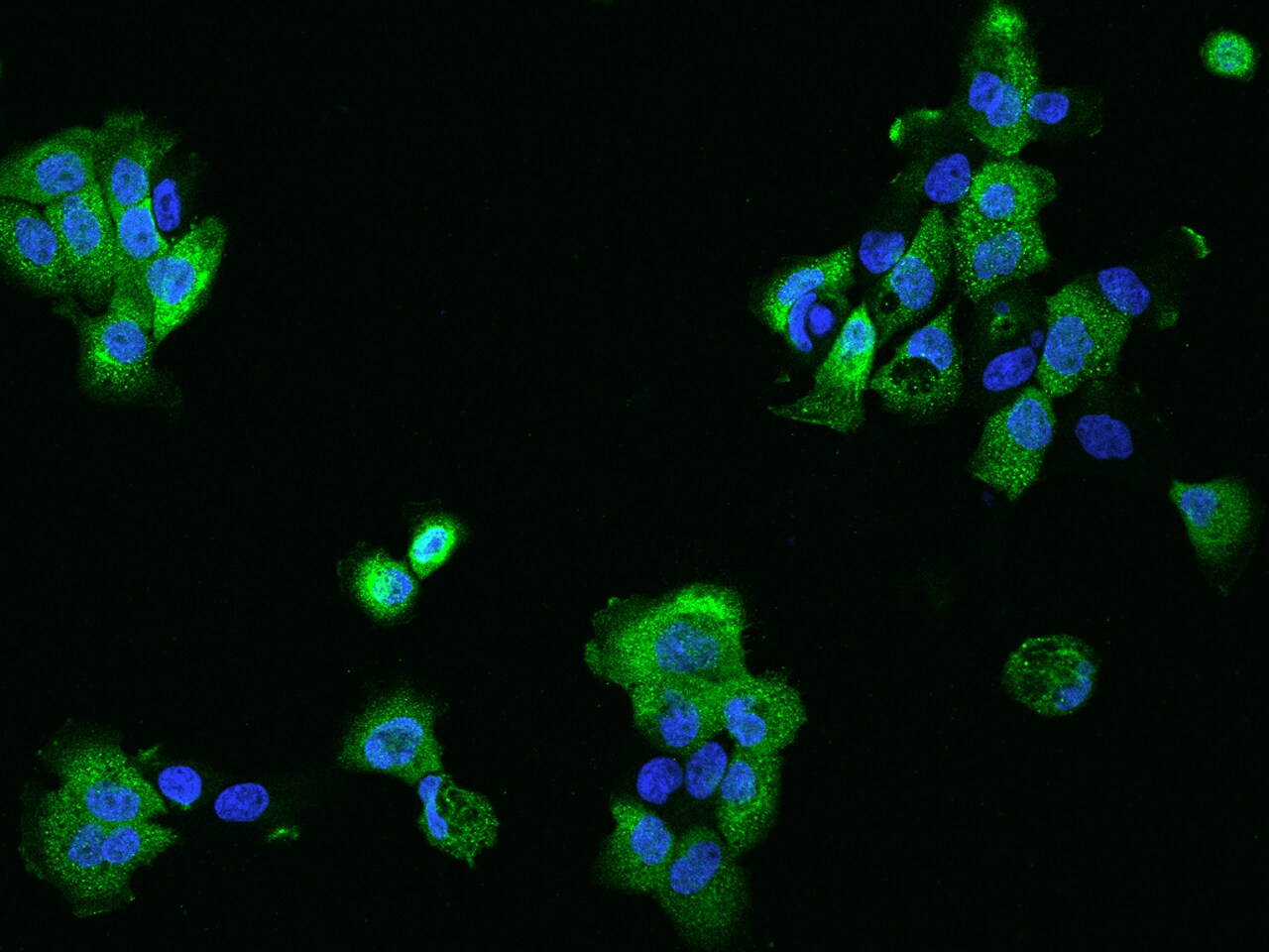 PHLDB2 Antibody - BSA Free