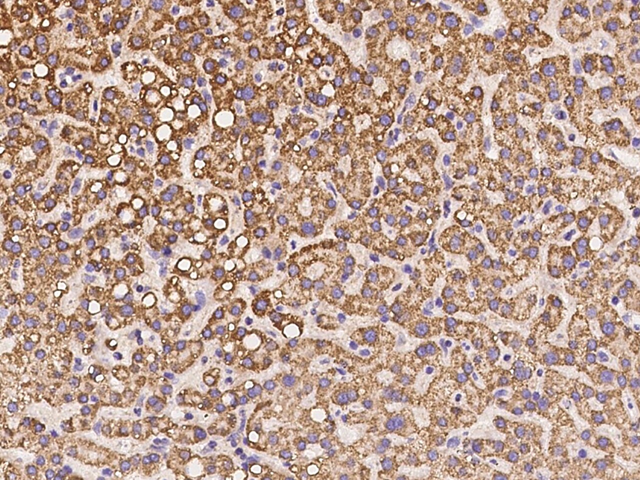 CLYBL Antibody - BSA Free