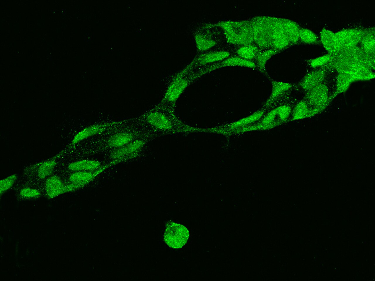 FUSIP1 Antibody - BSA Free