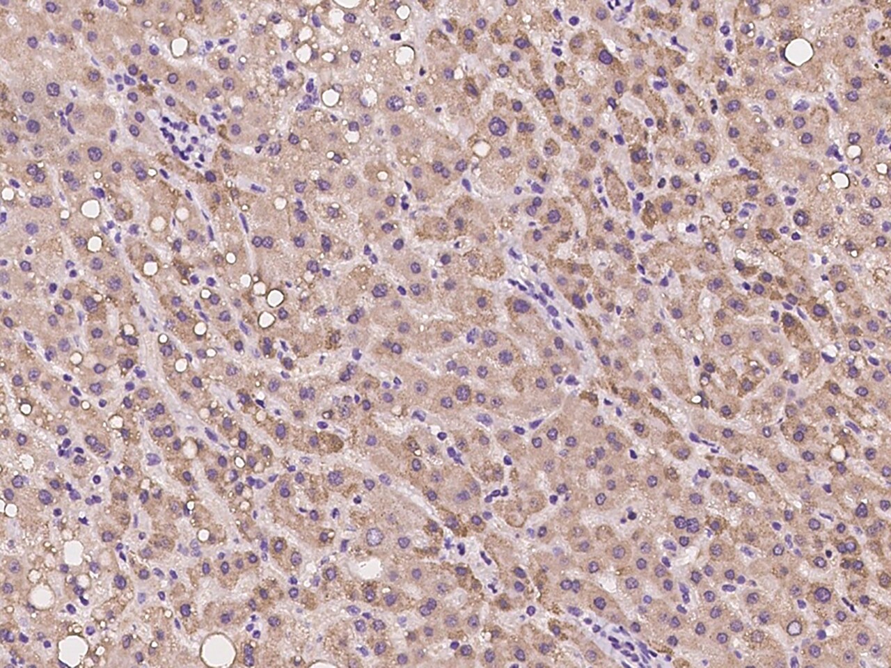 SPICE1 Antibody - BSA Free