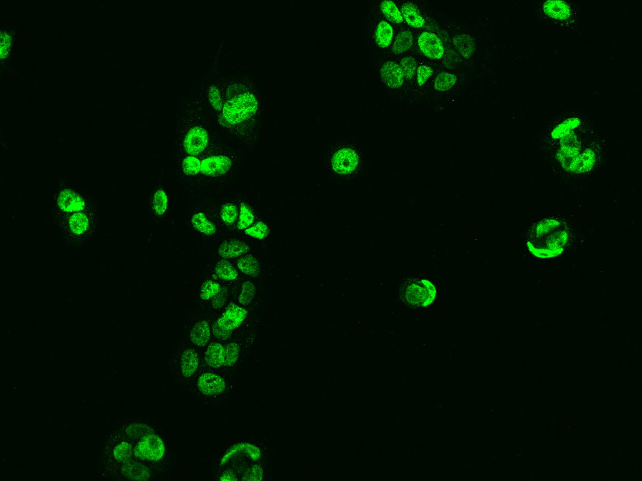 Scaffold attachment factor B2 Antibody - BSA Free