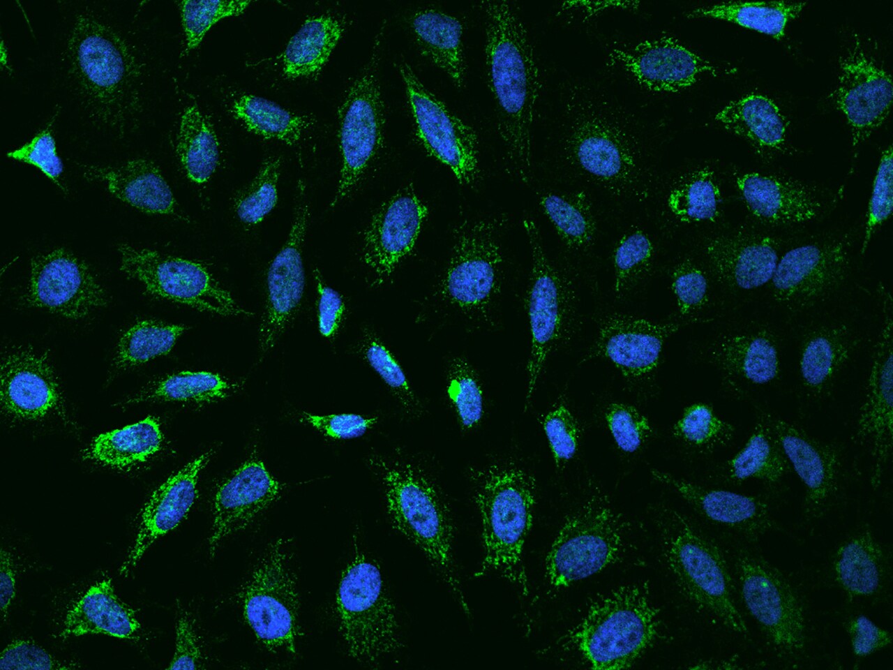Ankyrin Repeat Domain 33B Antibody - BSA Free