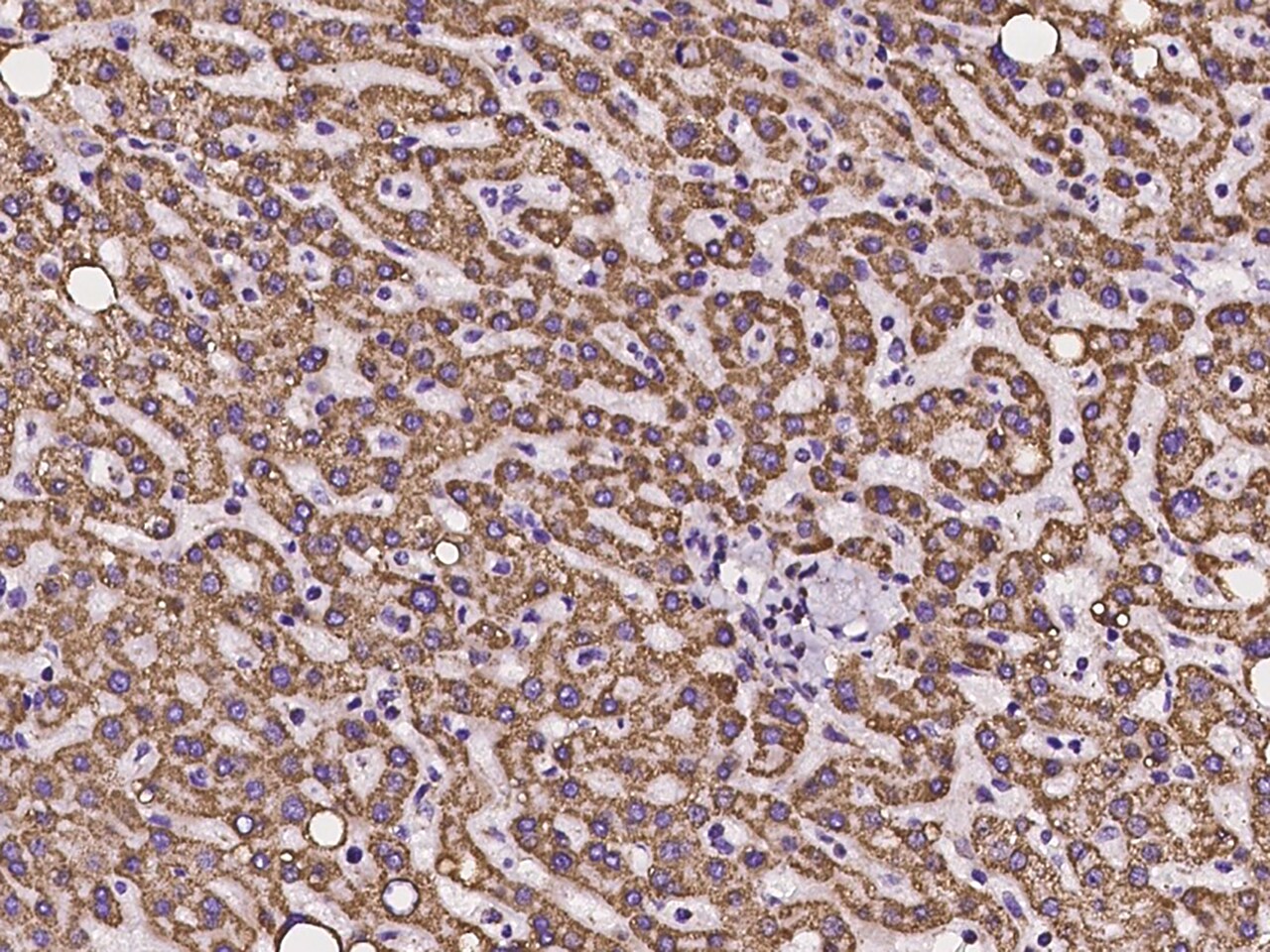 Ankyrin Repeat Domain 33B Antibody - BSA Free