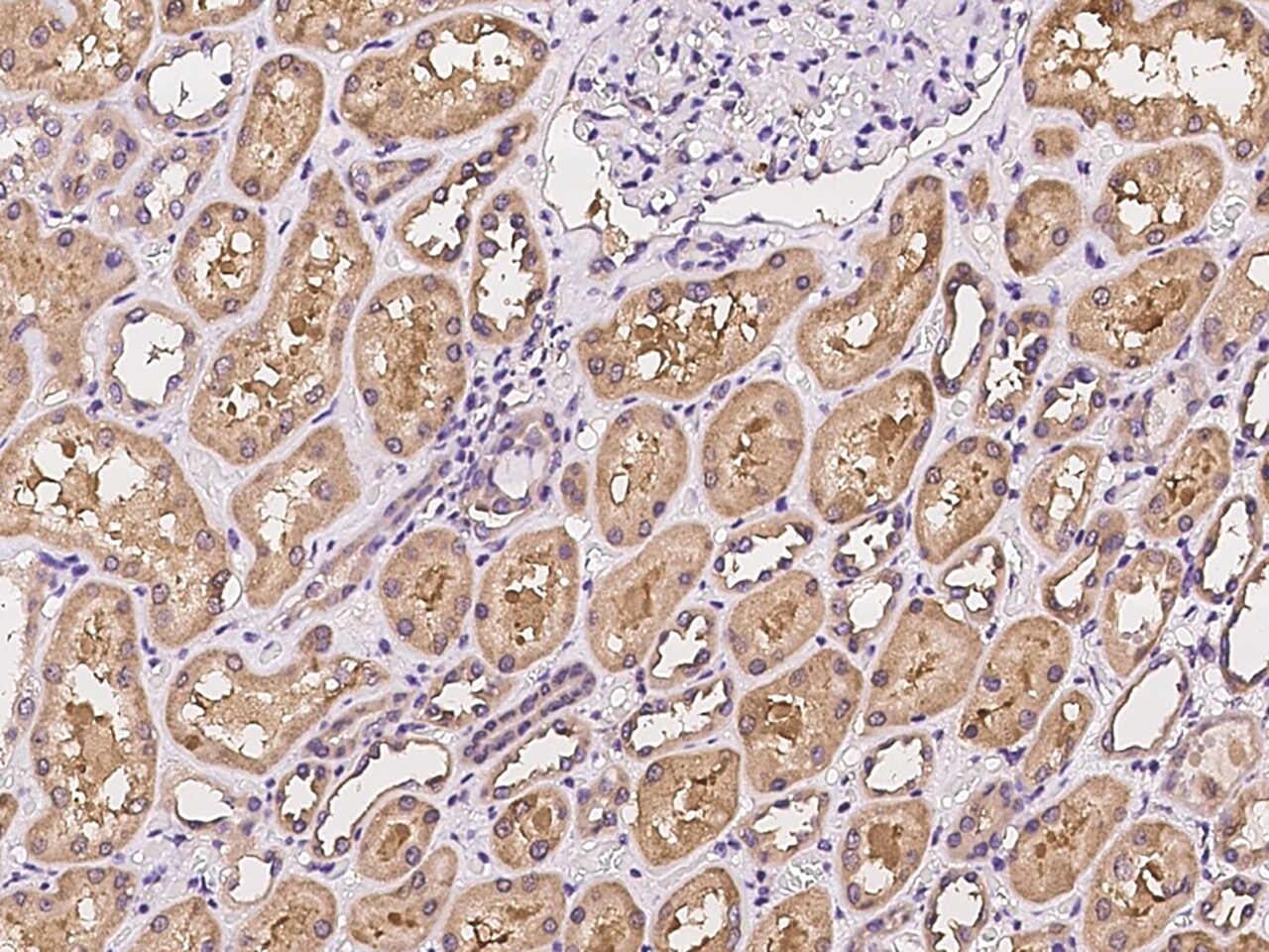 C6orf47 Antibody - BSA Free