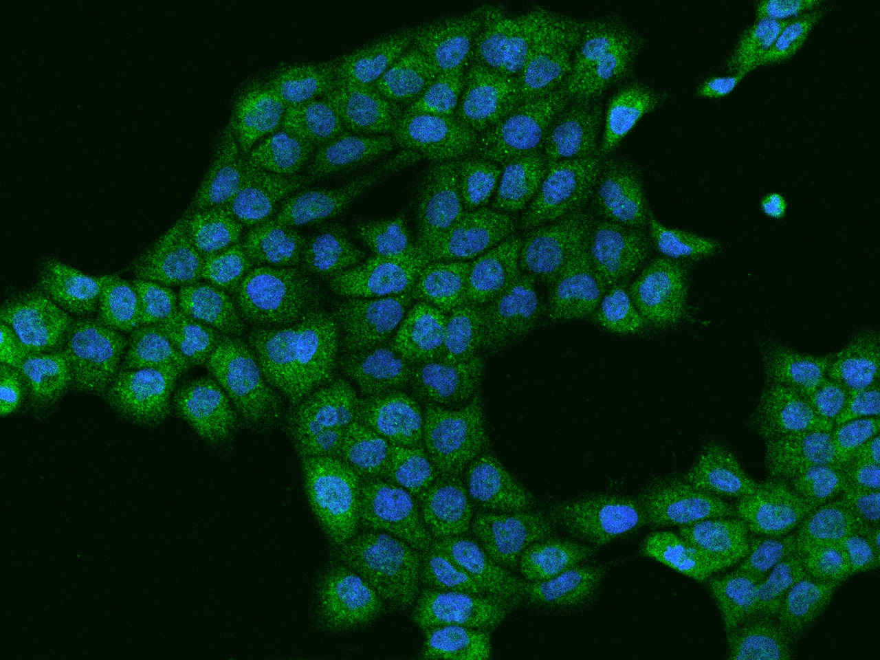 MYO9B Antibody - BSA Free