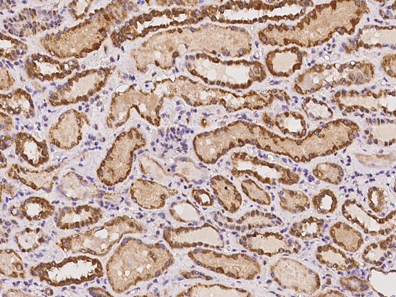 C20orf96 Antibody - BSA Free