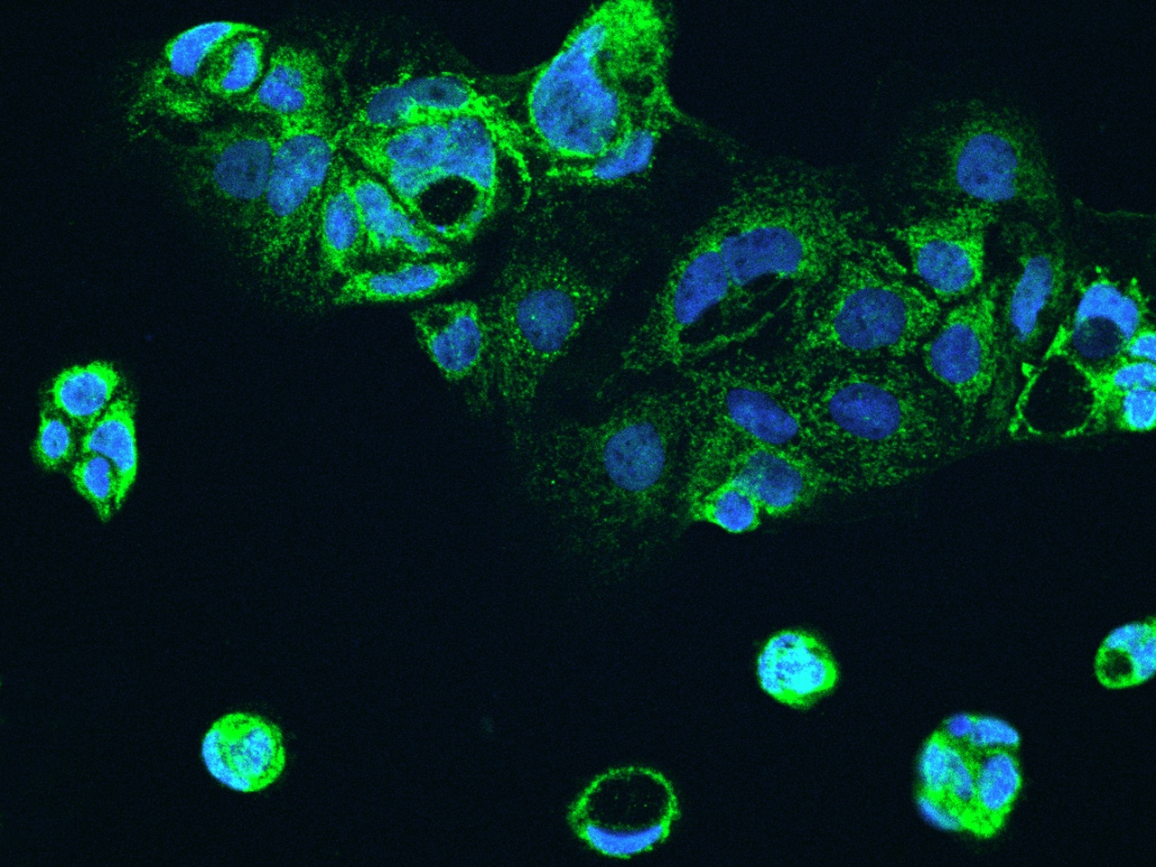ALDH5A1 Antibody - BSA Free