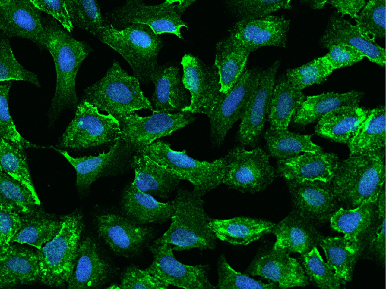 ODR4/TTG1 Antibody - BSA Free