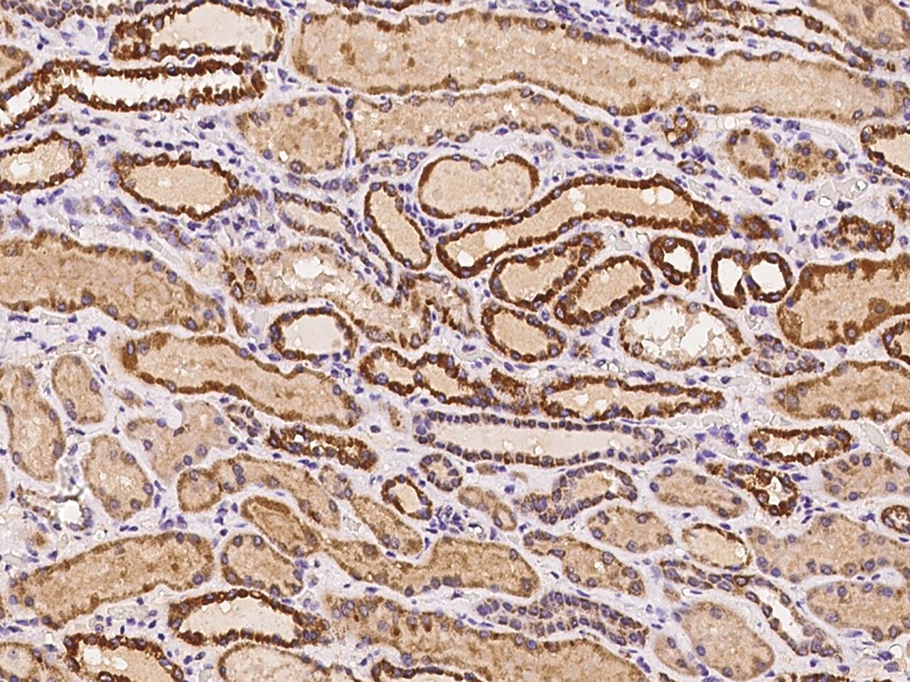 IBA57 Antibody - BSA Free