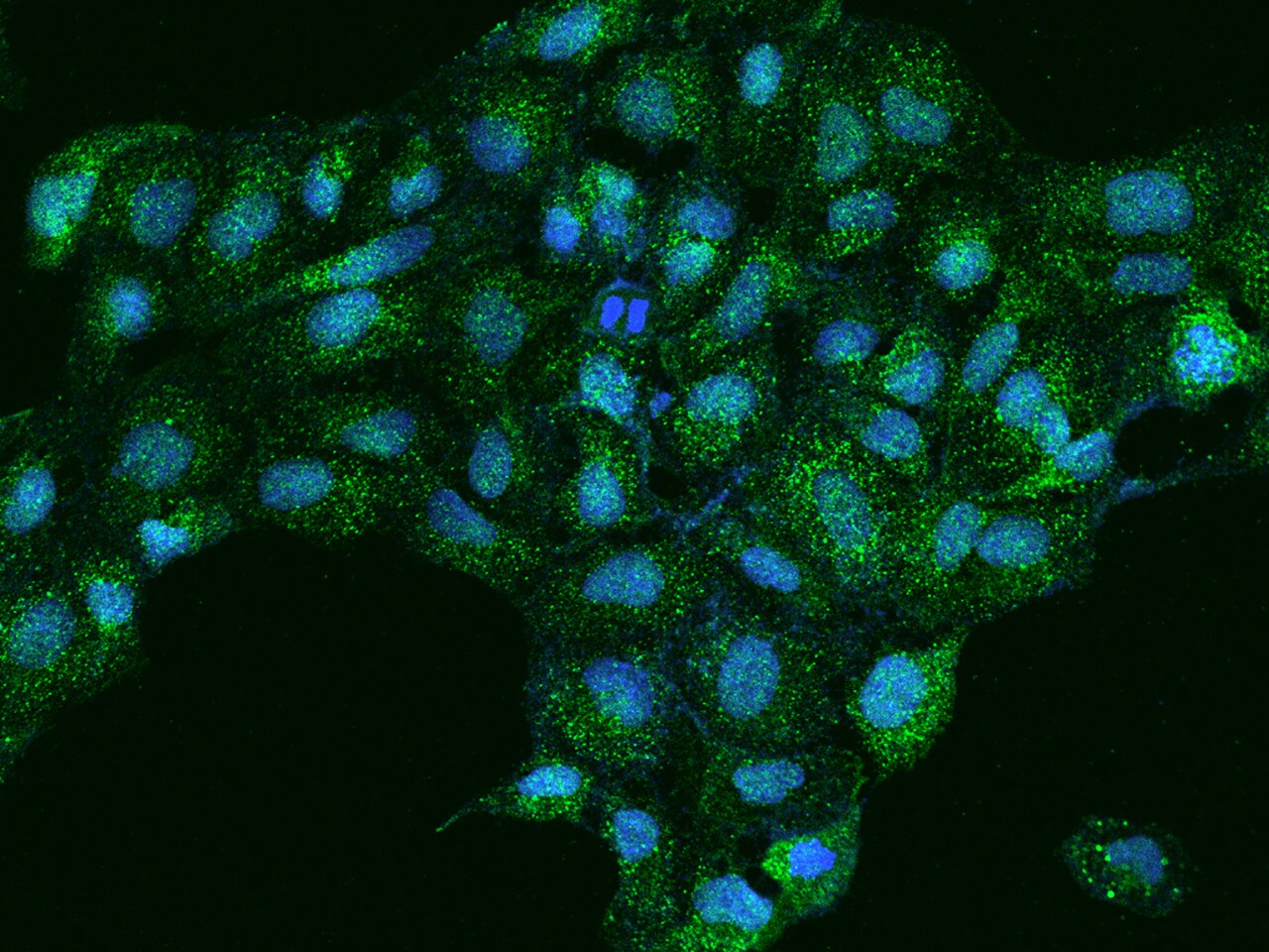 EPS8L3 Antibody - BSA Free