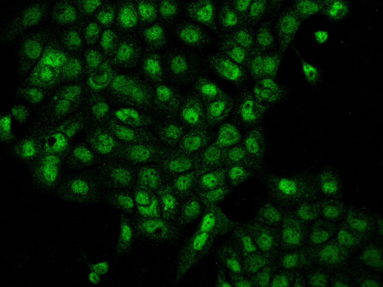 TSSC4 Antibody - BSA Free