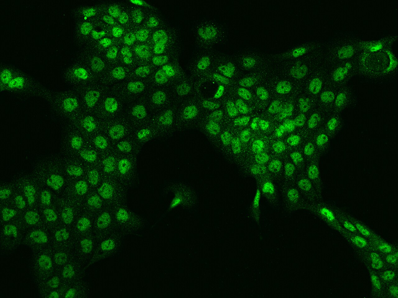 TESK2 Antibody - BSA Free