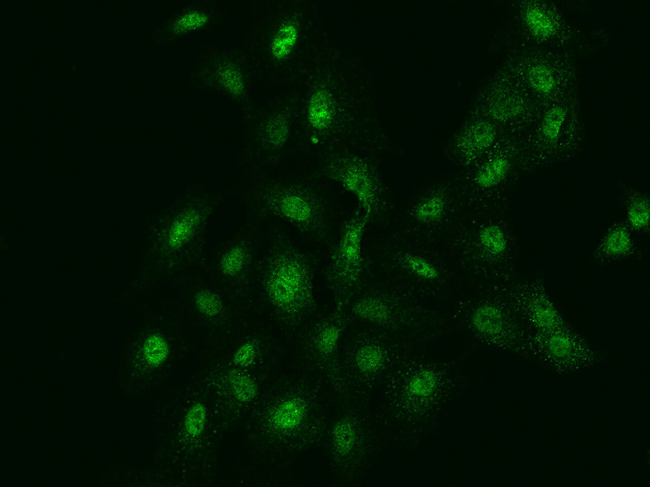 FANCG Antibody - BSA Free