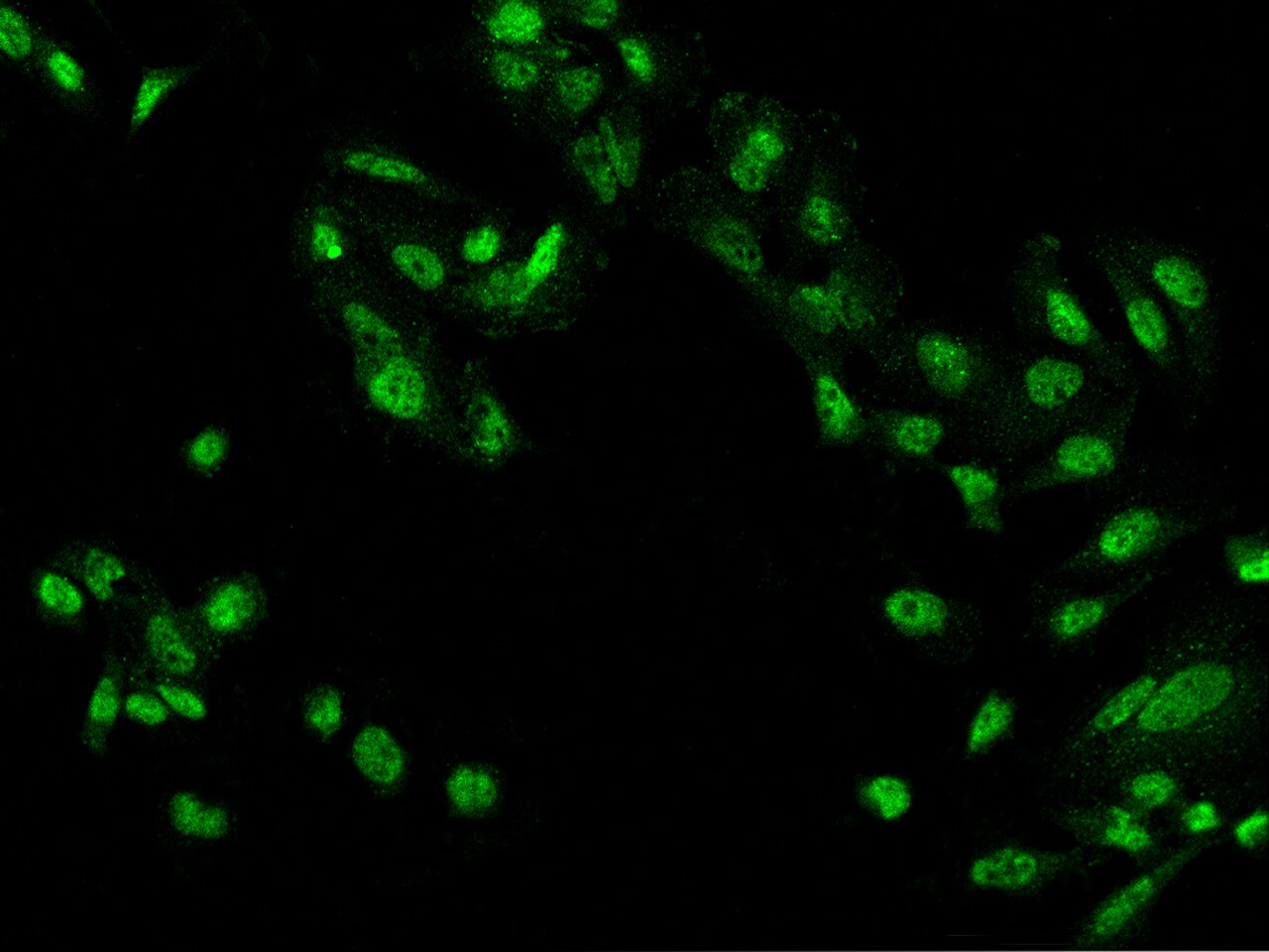 ZBTB20 Antibody - BSA Free