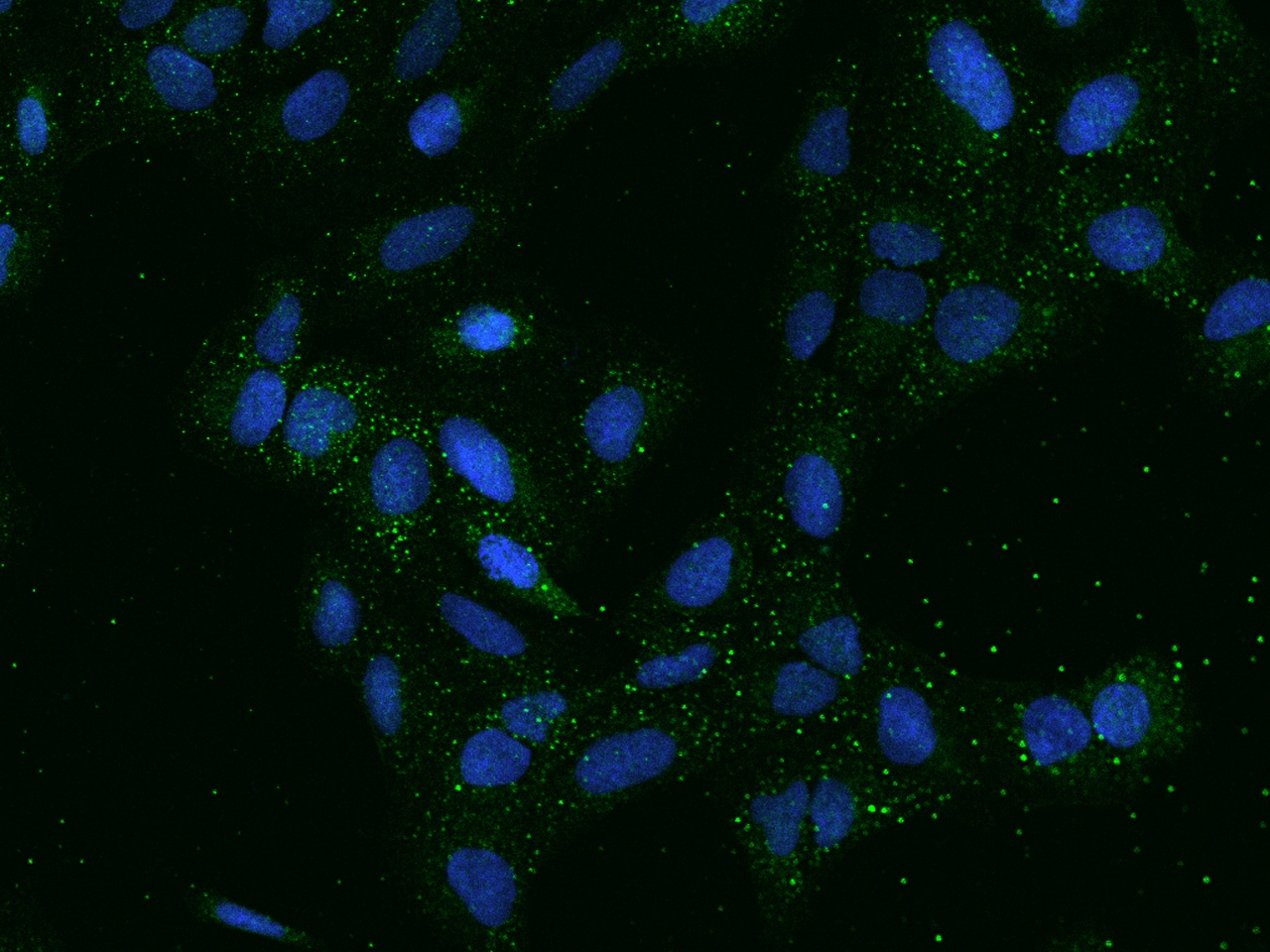 SMIM5 Antibody - BSA Free