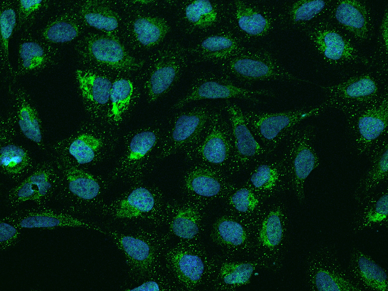 SMIM4 Antibody - BSA Free
