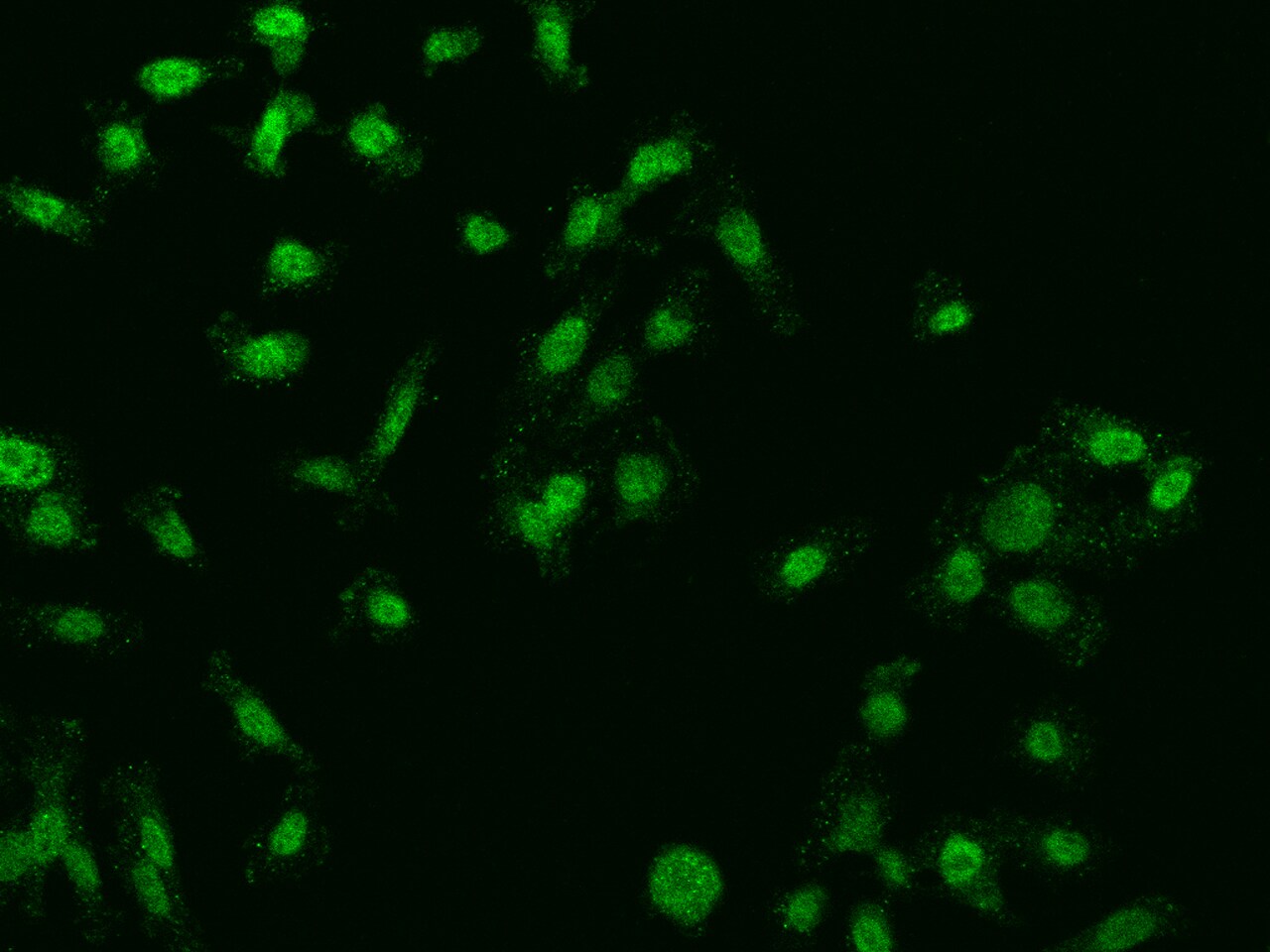 FBXO27 Antibody - BSA Free