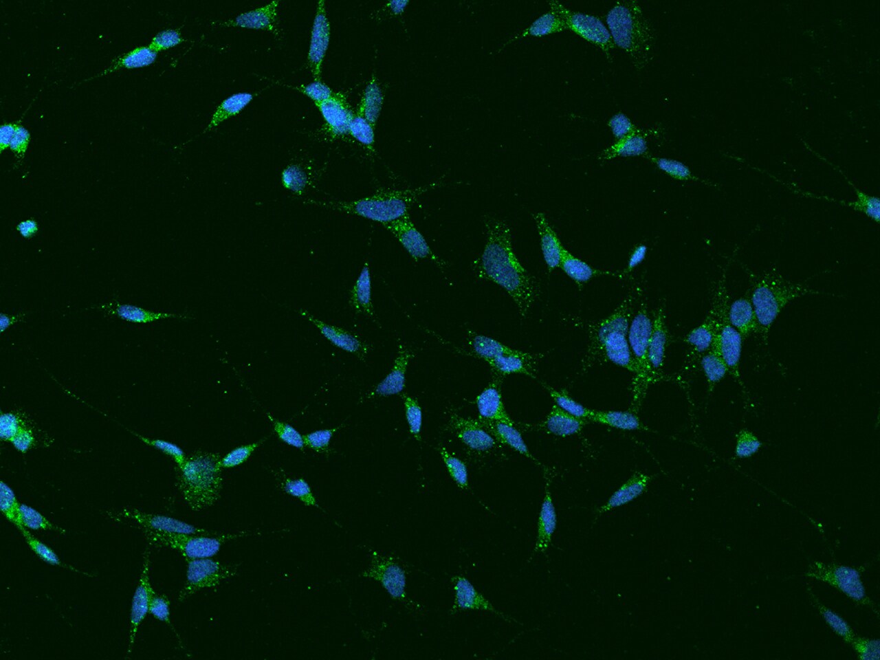 TVP23A Antibody - BSA Free