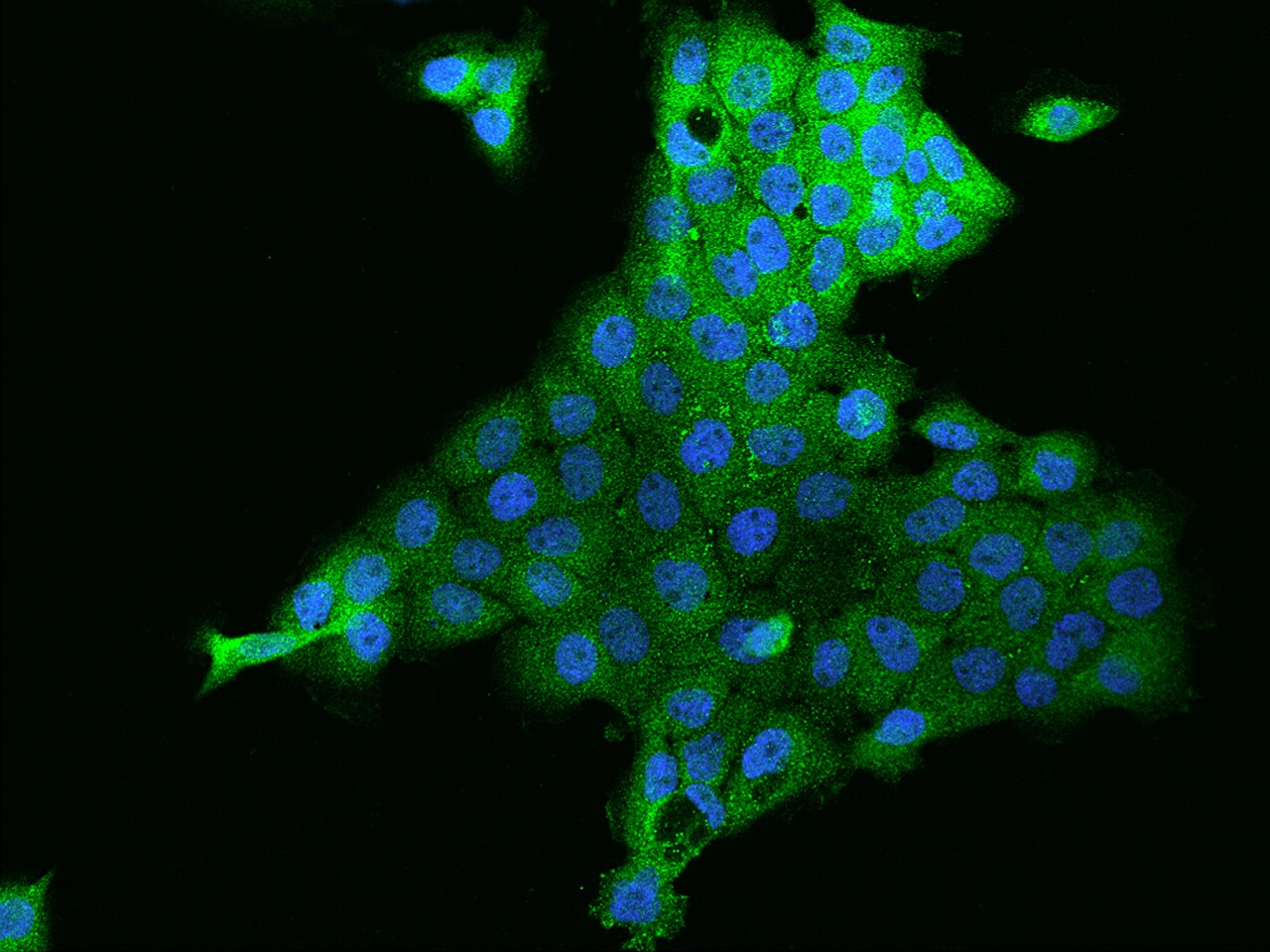 Zinc finger protein 772 Antibody - BSA Free