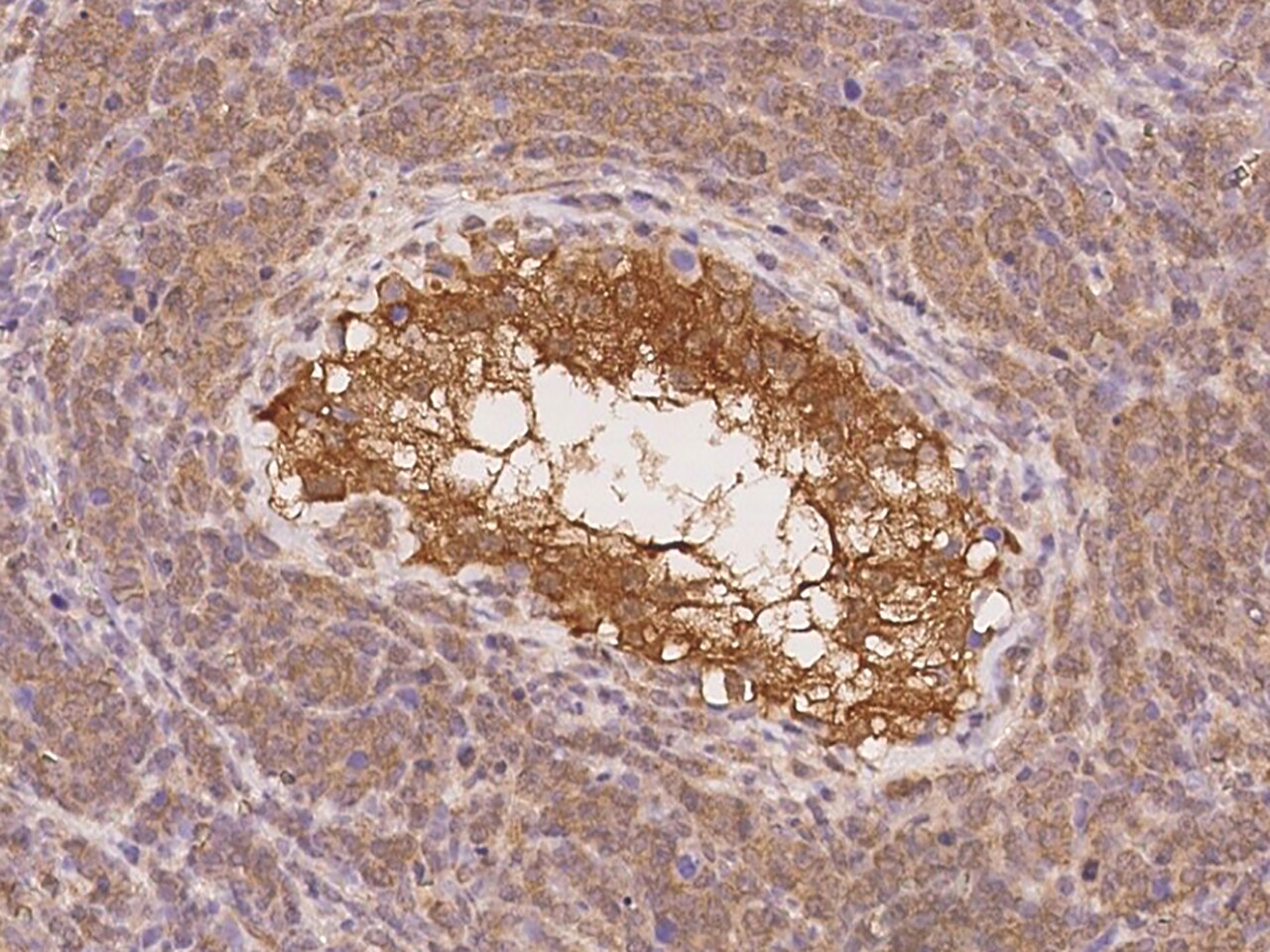 SOWAHD Antibody