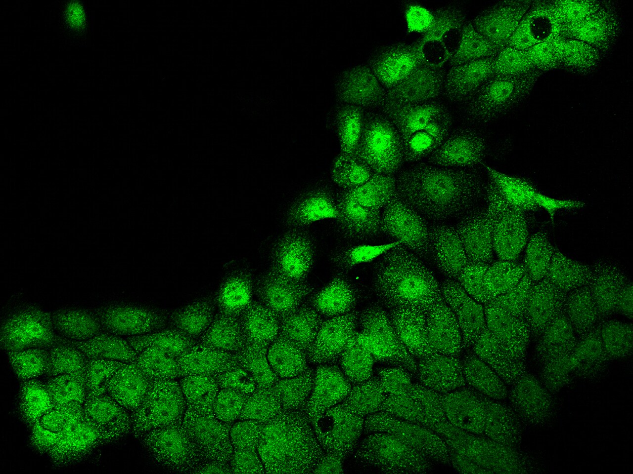 POLR3H Antibody - BSA Free