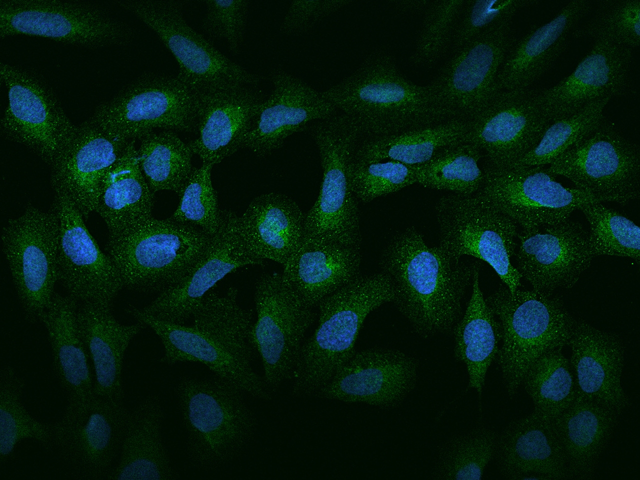Cathepsin A/Lysosomal Carboxypeptidase A Antibody - BSA Free