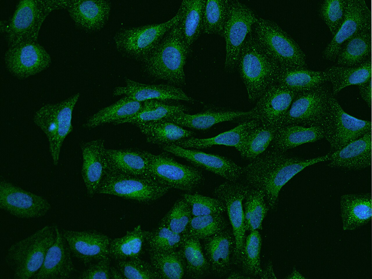 P2X5/P2RX5 Antibody - BSA Free