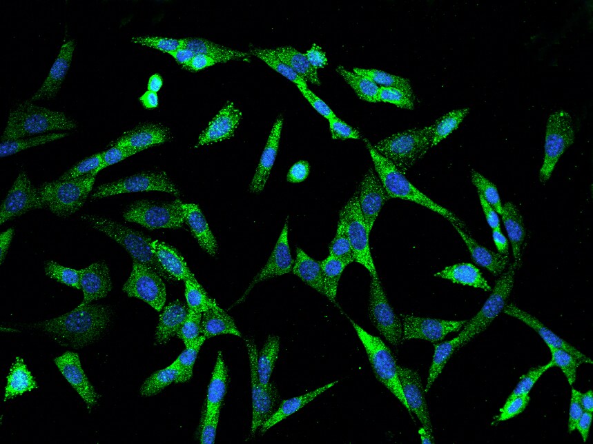 CRABP2 Antibody - Azide and BSA Free