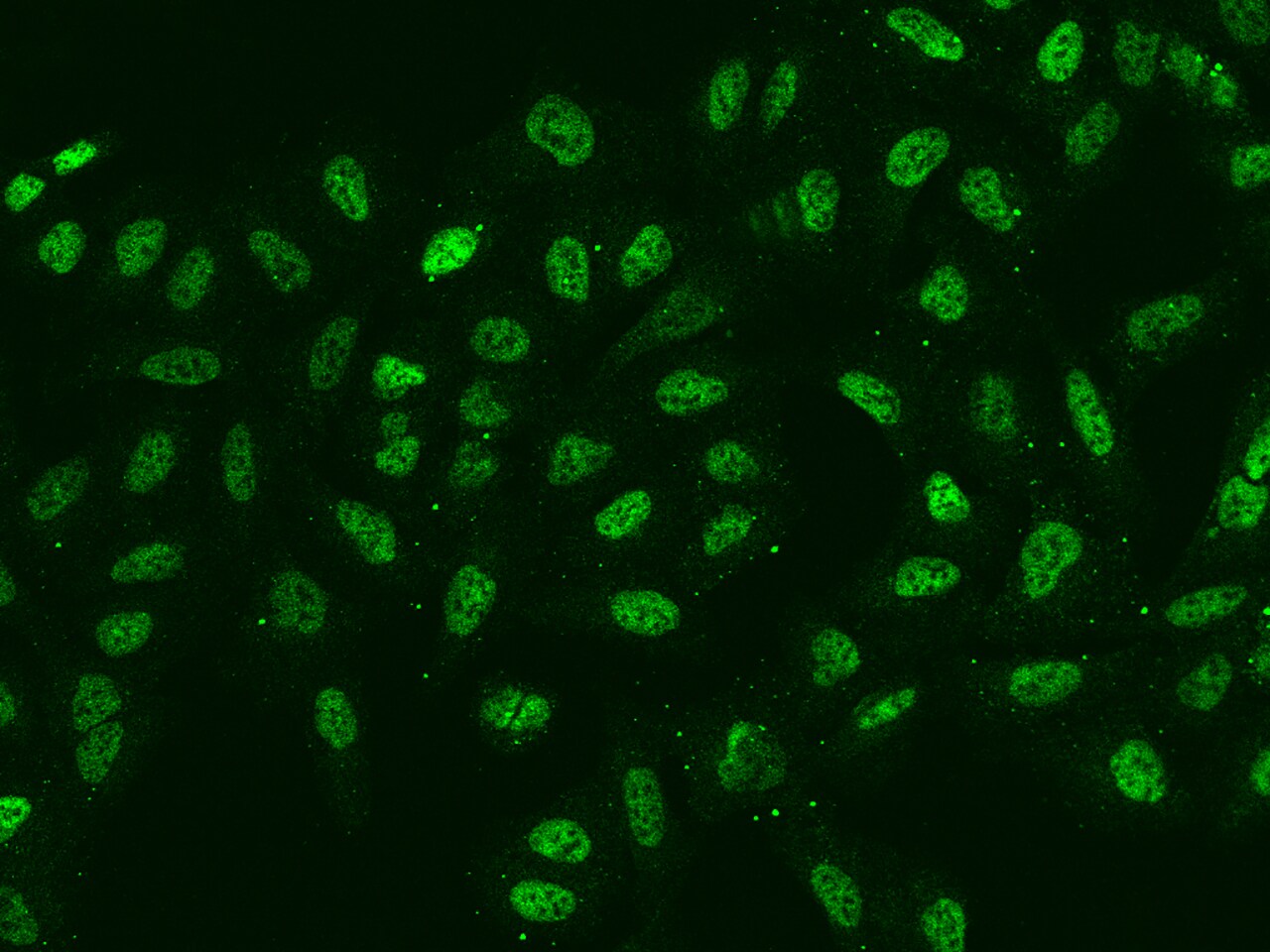 SIX4 Antibody - BSA Free