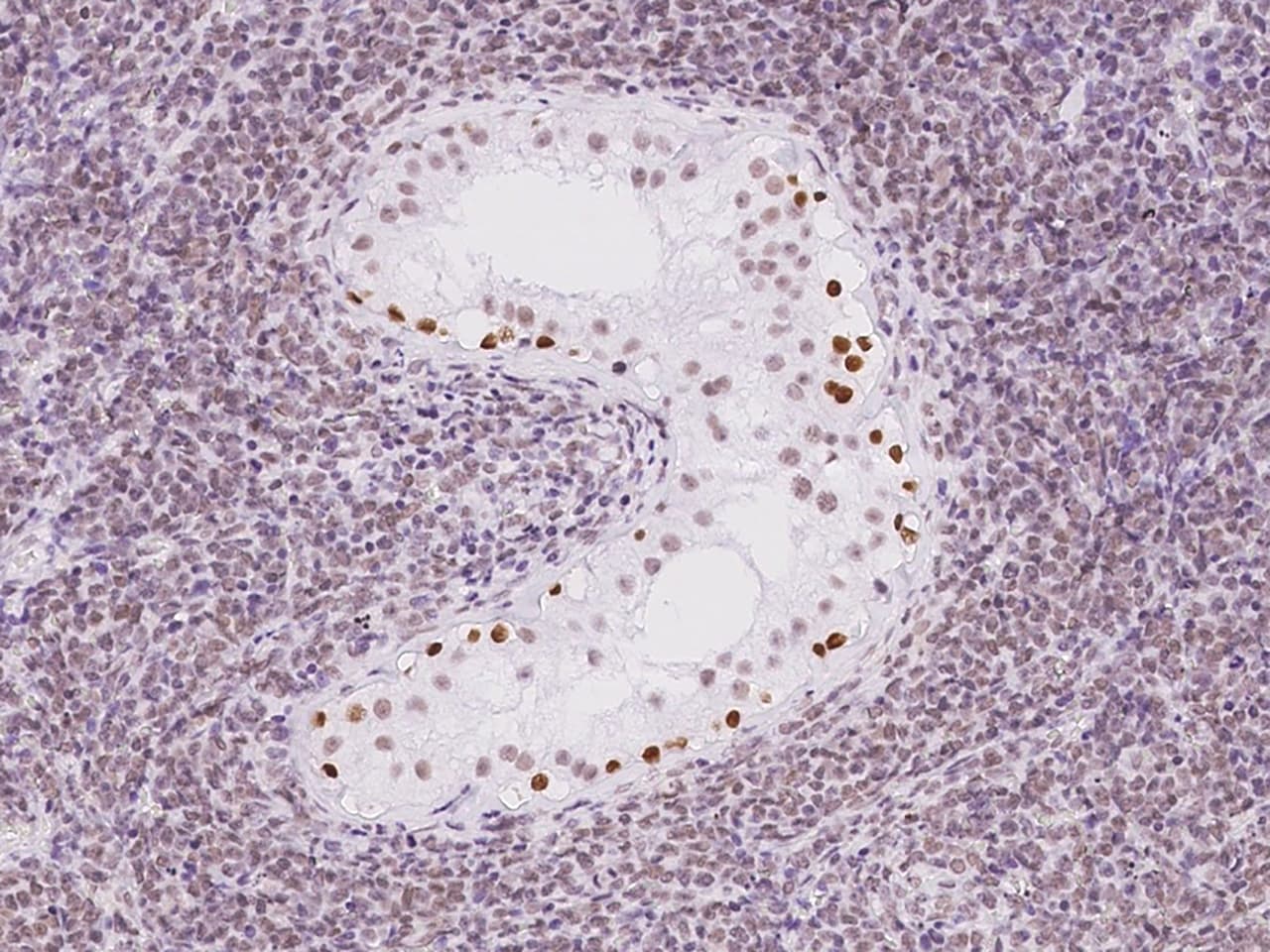 THYN1 Antibody