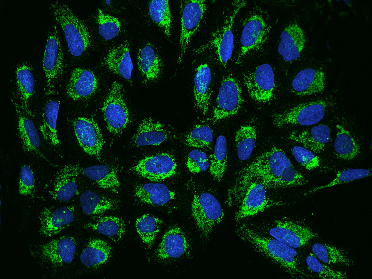 TIMM17B Antibody - BSA Free