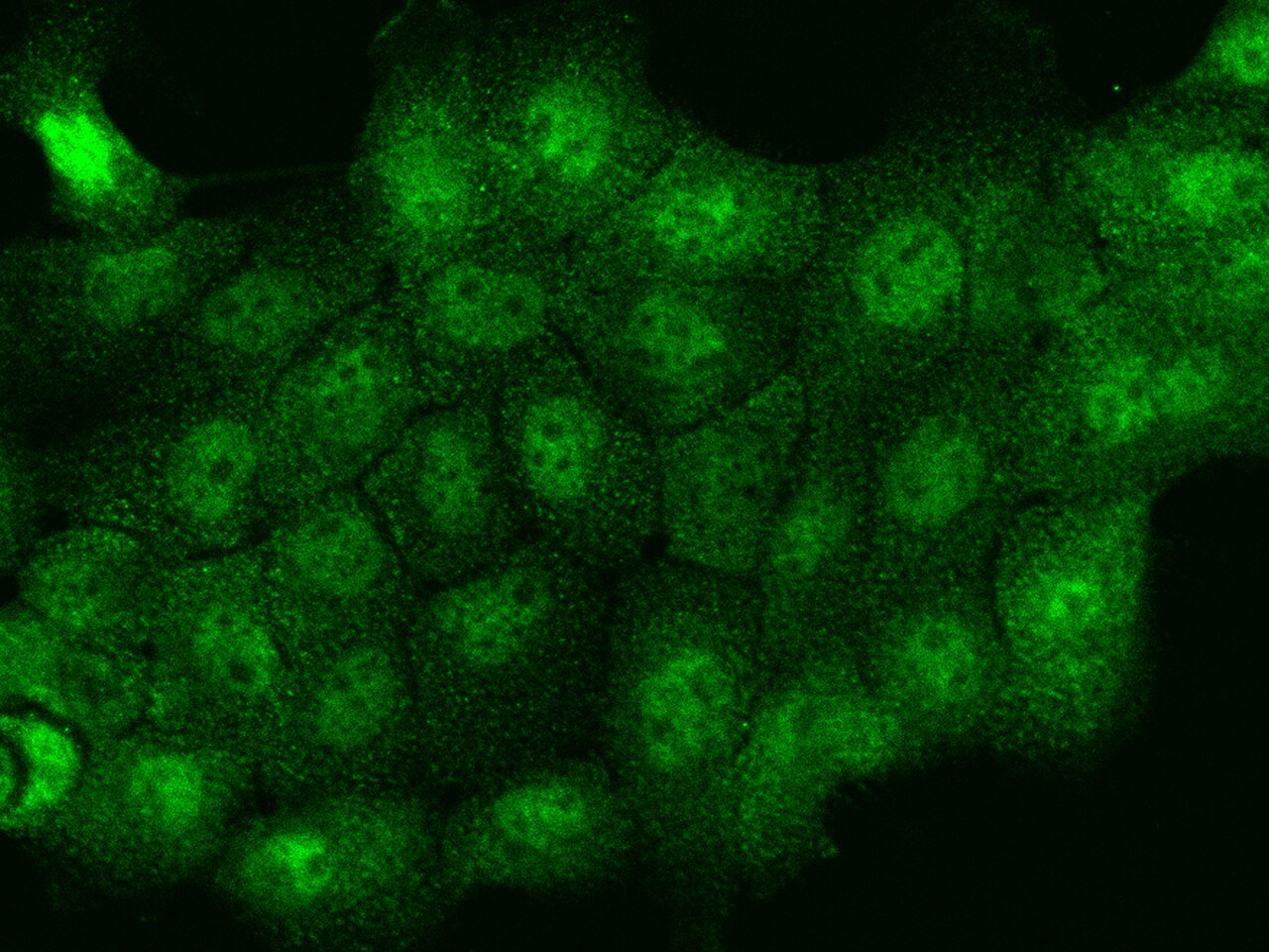 THRSP Antibody - BSA Free