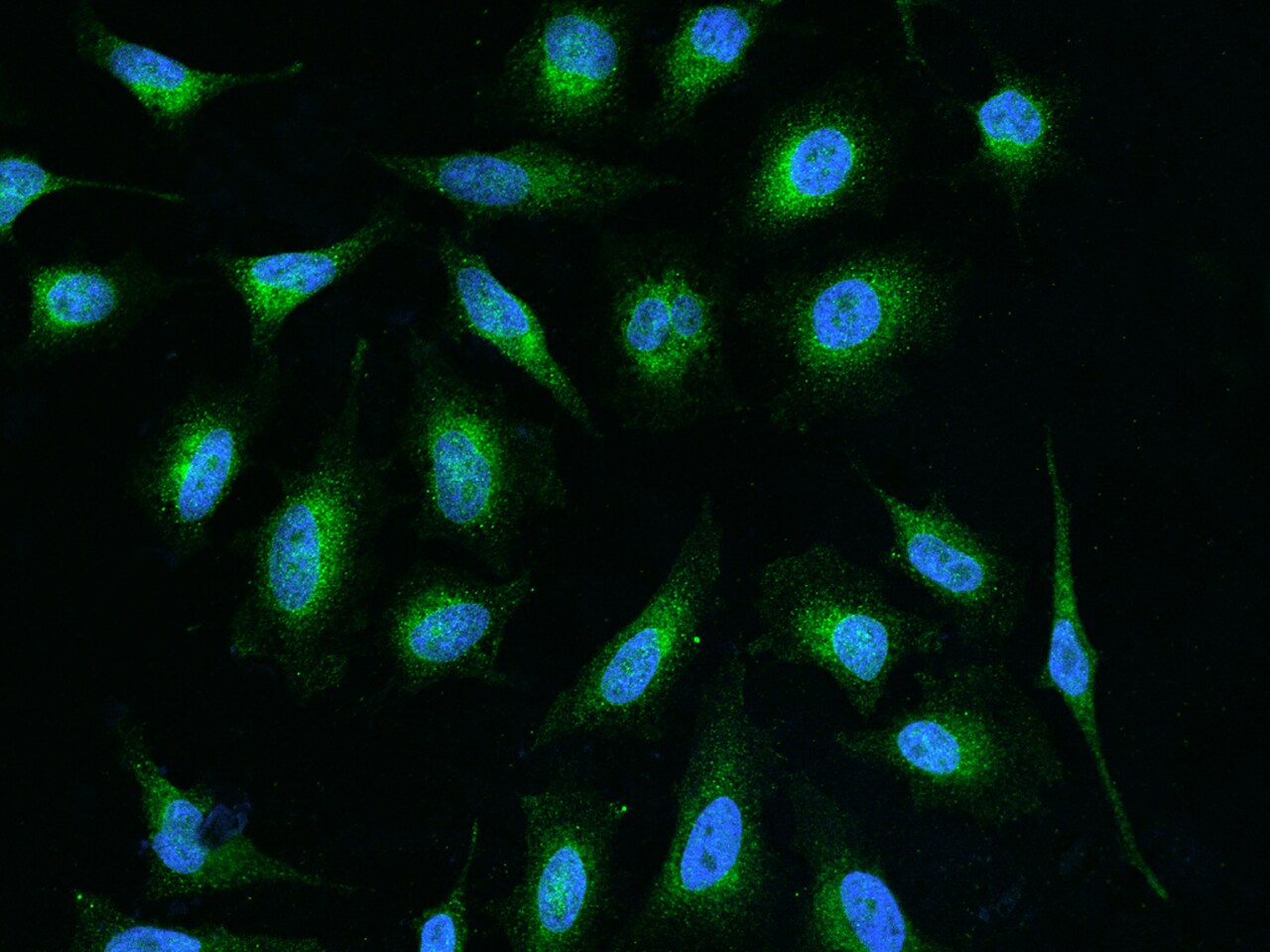GGCX Antibody - BSA Free