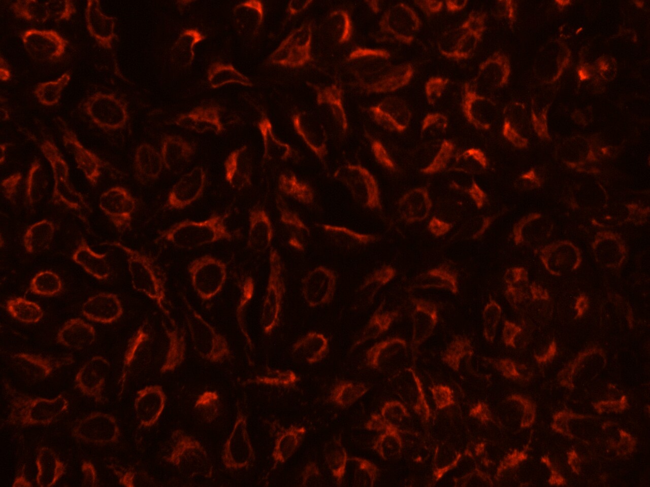 TBRG4 Antibody - BSA Free