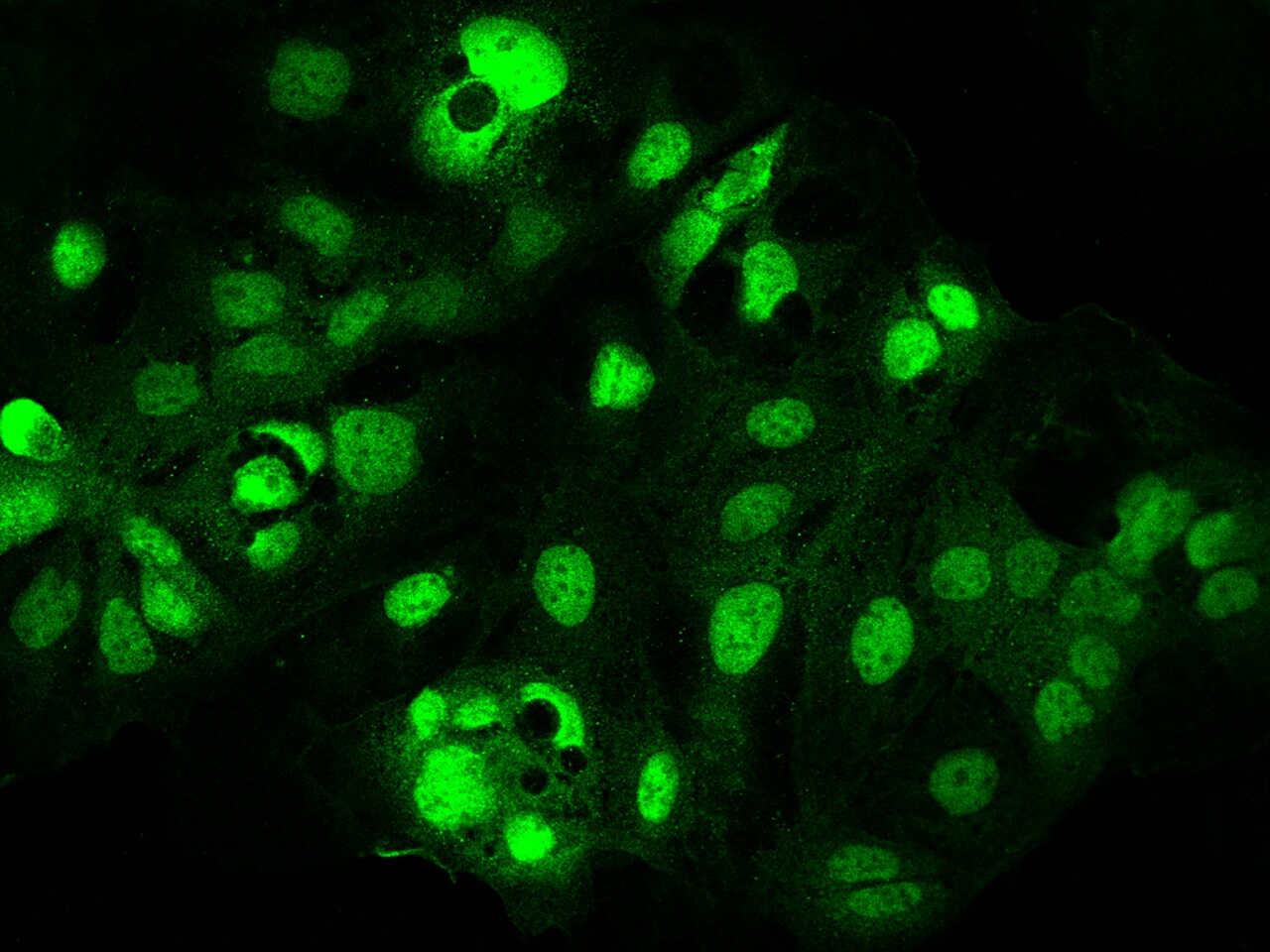 PEPT1/SLC15A1 Antibody - BSA Free