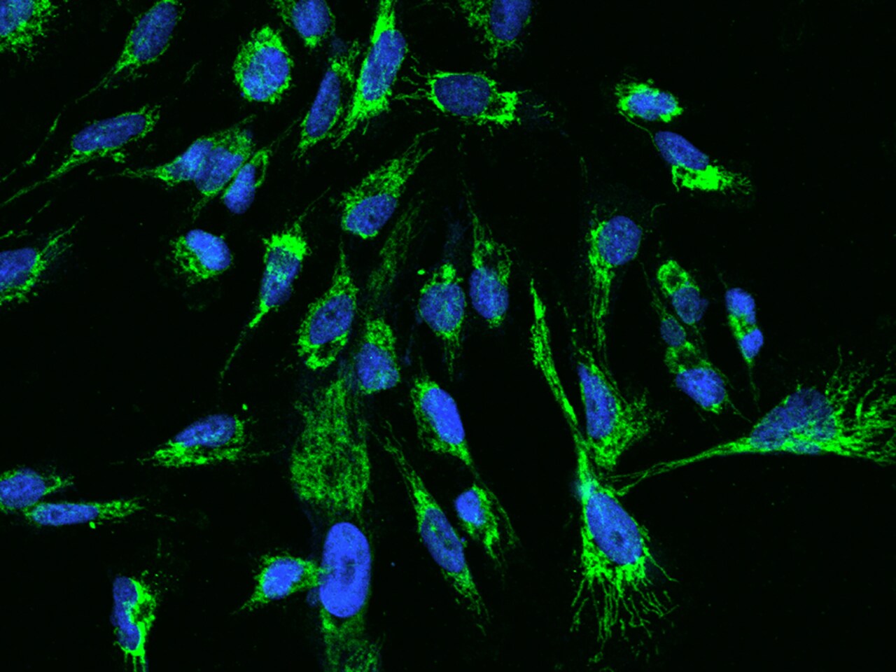 TTC19 Antibody - BSA Free