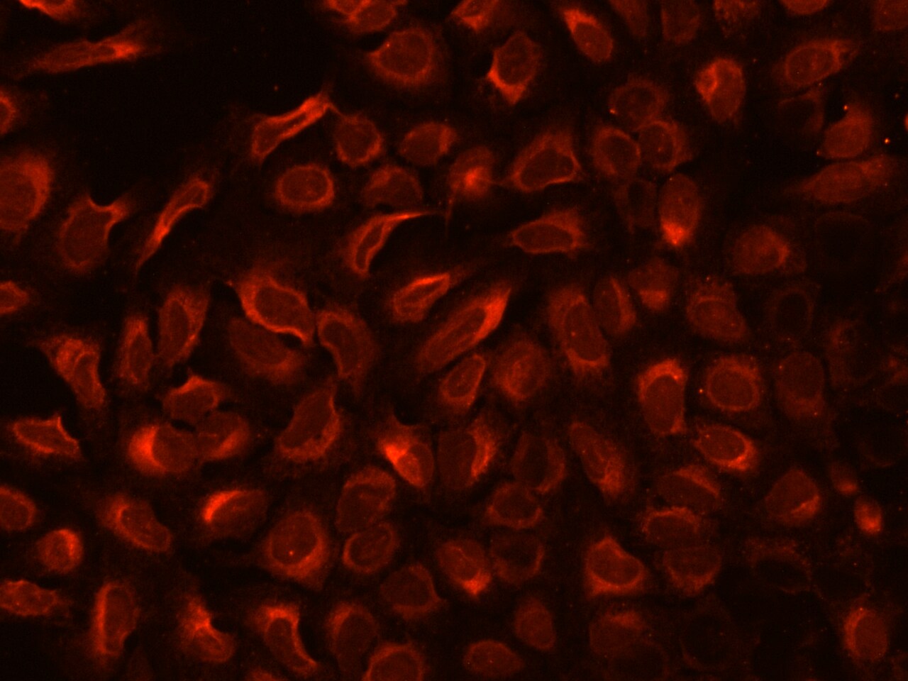 TXNDC5 Antibody - BSA Free