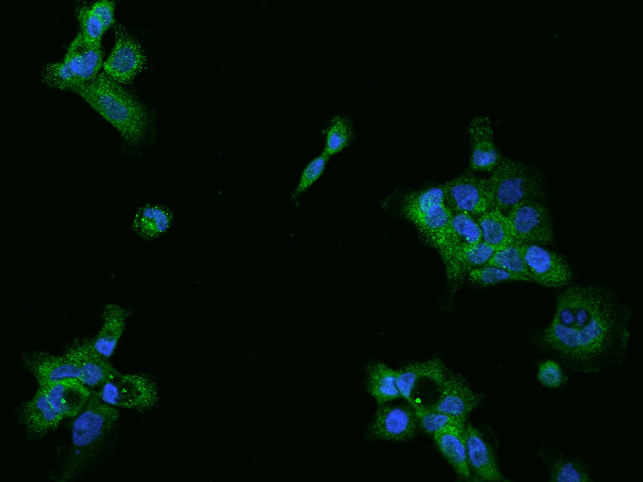 UBAP1 Antibody - BSA Free