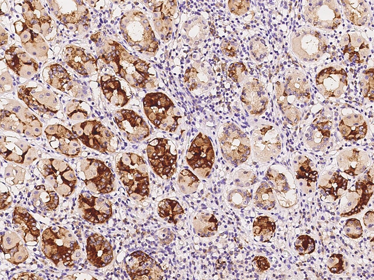 UCKL1 Antibody - BSA Free