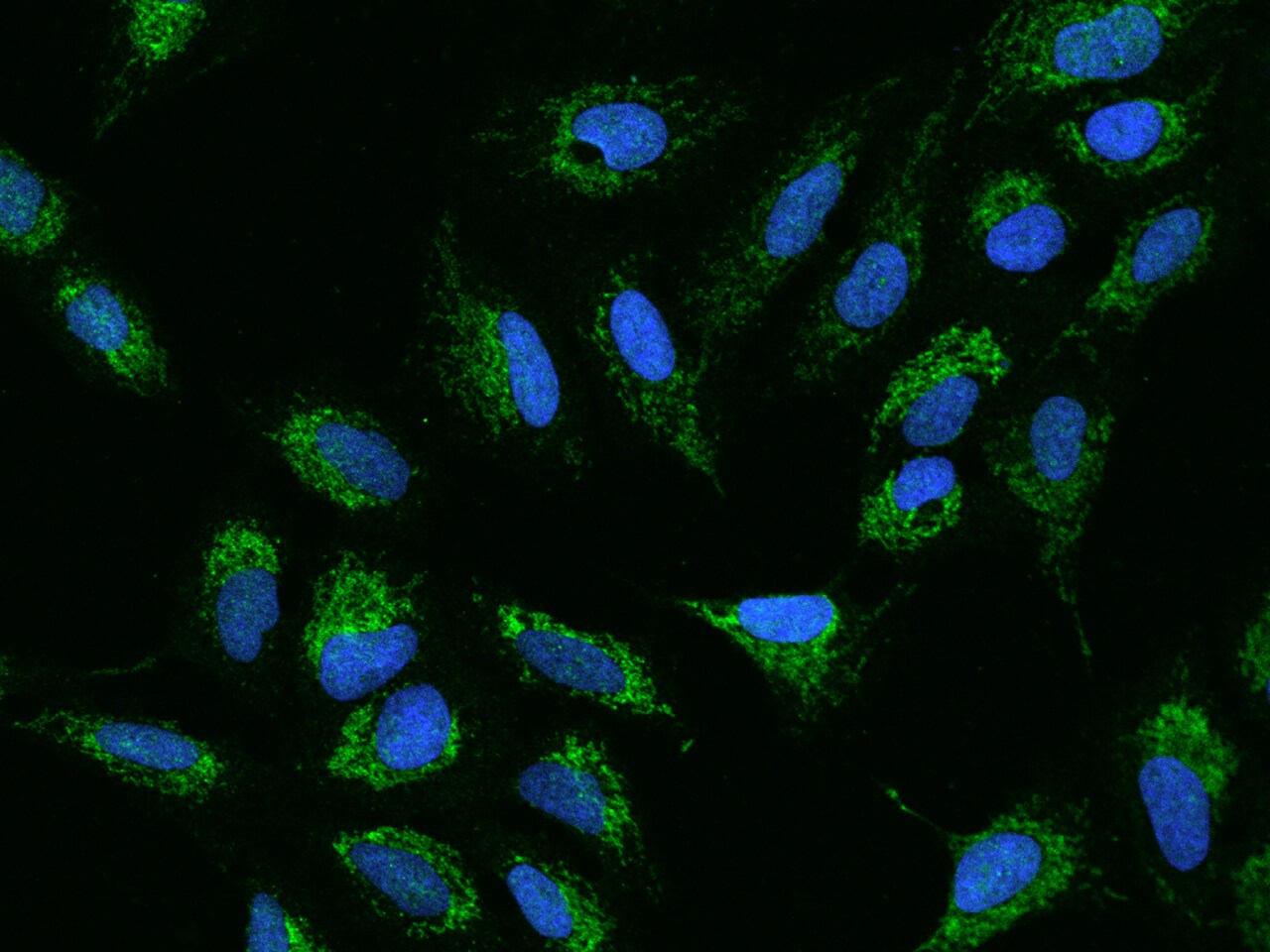 ADCK4 Antibody - BSA Free