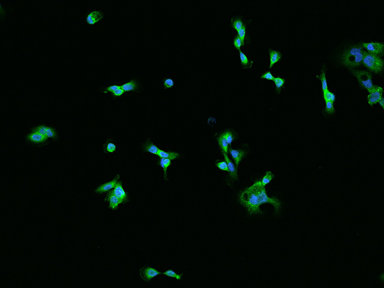 AHCYL1 Antibody - BSA Free