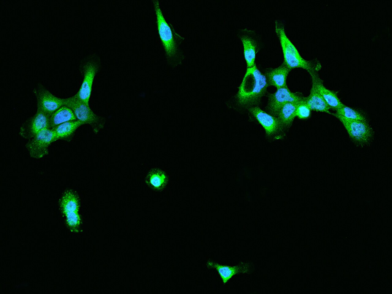 Aminopeptidase P1/XPNPEP1 Antibody - BSA Free