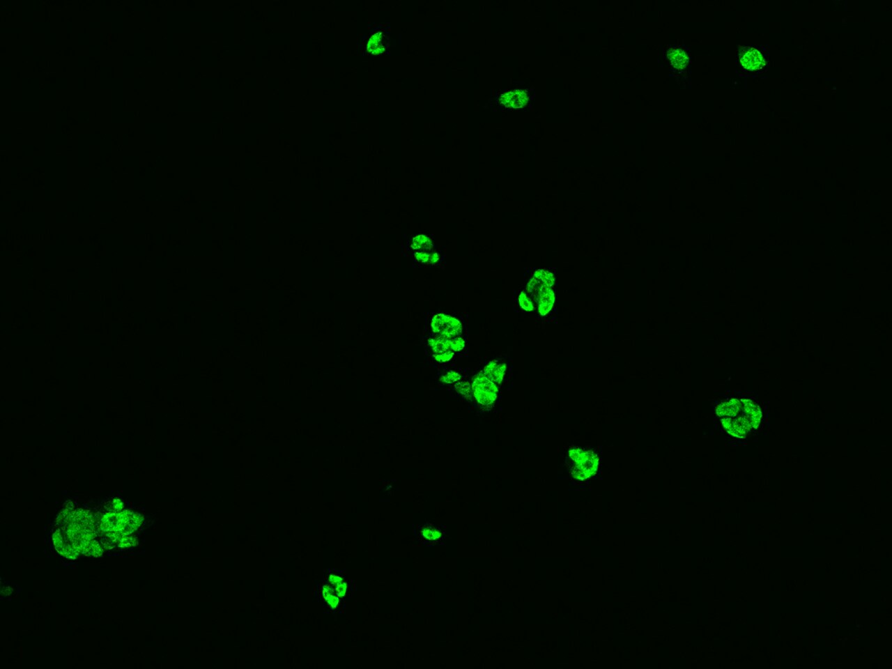 hnRNP C1 + C2 Antibody - BSA Free