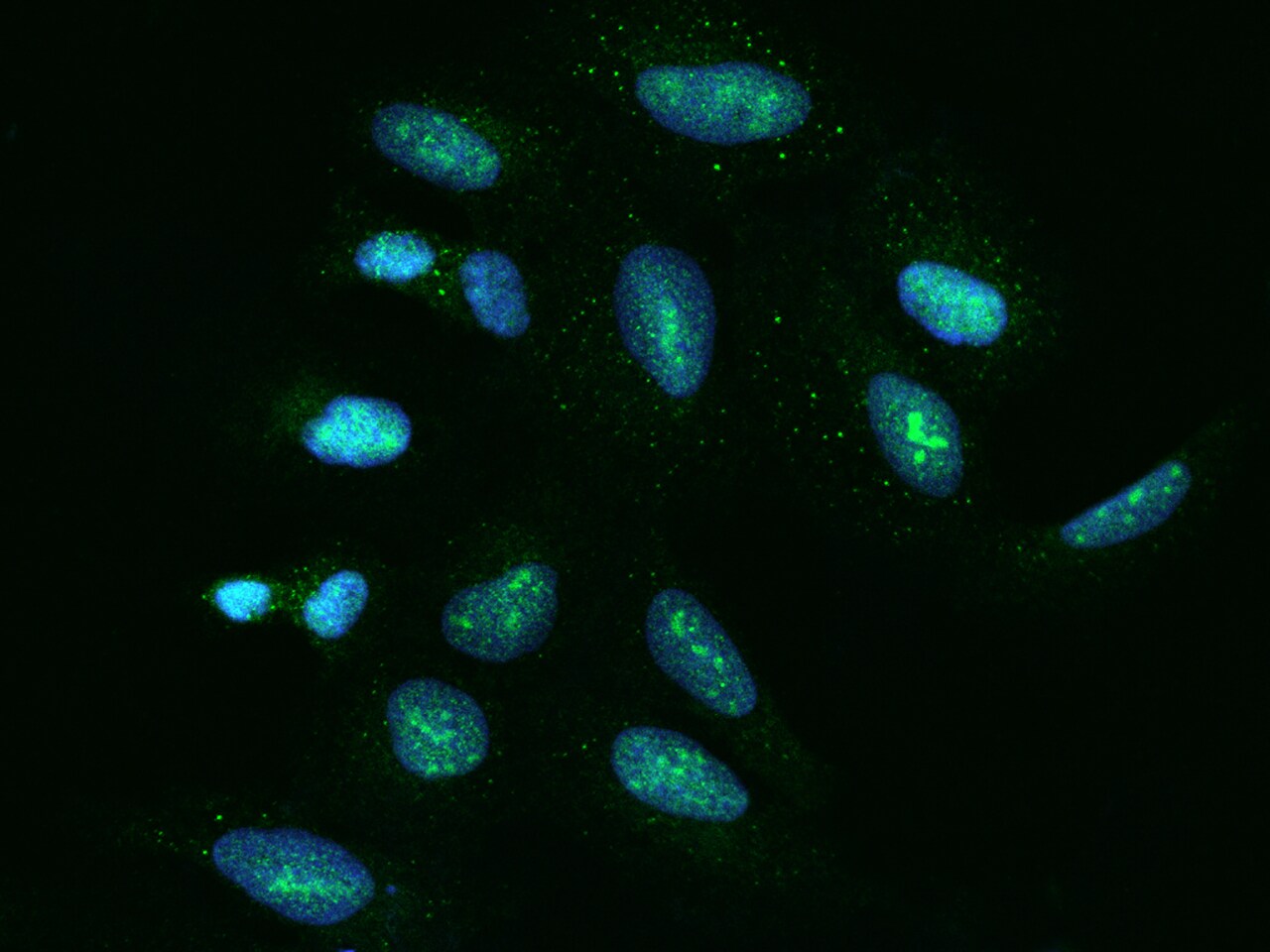SDAD1 Antibody - BSA Free